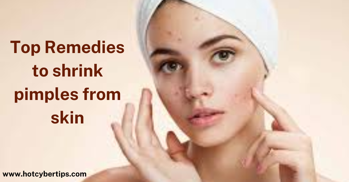 Read more about the article Top Remedies to shrink pimples from skin