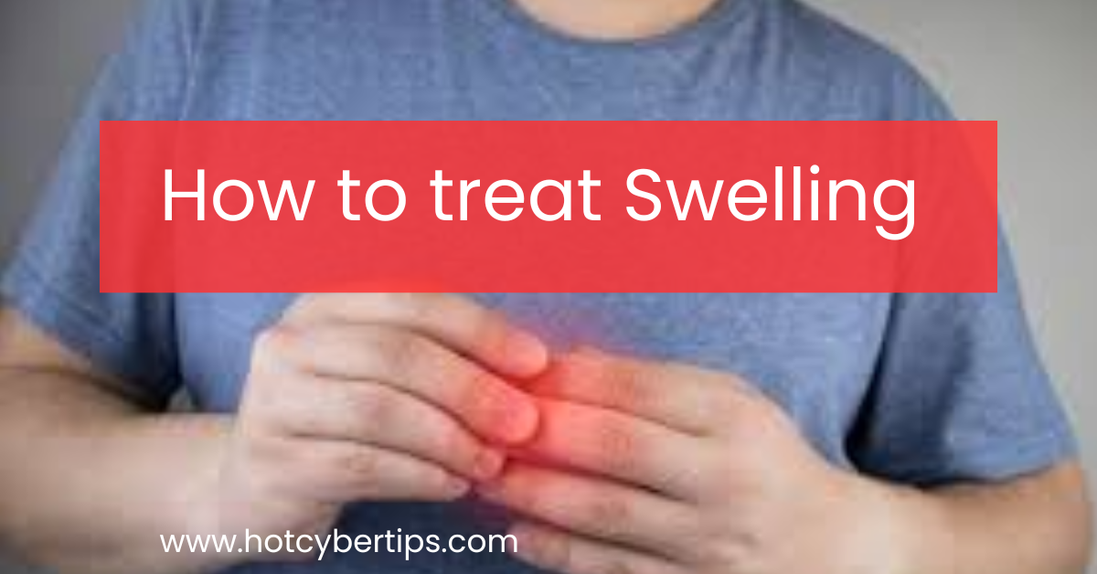Read more about the article How to treat Swelling